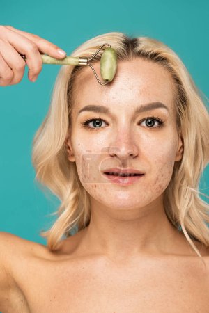 Téléchargez les photos : Gros plan de femme blonde avec visage levant l'acné avec rouleau de jade isolé sur turquoise - en image libre de droit