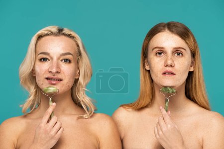 Foto de Mujer con acné y modelo pelirroja con pecas usando rodillos de jade aislados en turquesa - Imagen libre de derechos