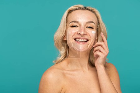 Foto de Mujer rubia feliz con acné aplicando crema en la cara aislada en turquesa - Imagen libre de derechos