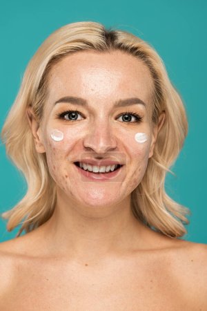 Téléchargez les photos : Femme heureuse avec des problèmes de peau appliquer la crème de traitement sur le visage isolé sur turquoise - en image libre de droit
