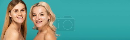 Photo for Cheerful women with different skin conditions and cream on faces looking at camera isolated on turquoise, banner - Royalty Free Image
