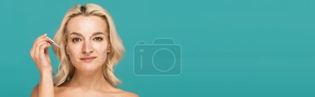 blonde woman with skin imperfections on face holding pipette with treatment serum isolated on turquoise, banner  tote bag #648034396