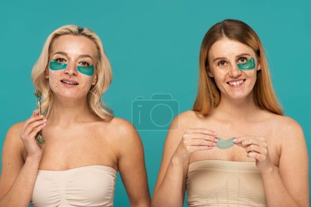 mujeres alegres con diferentes condiciones de la piel y parches bajo los ojos sonriendo aislado en turquesa 