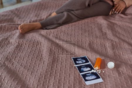 Téléchargez les photos : Pilule contraceptive près de l'échographie photo, femme afro-américaine au lit, prise de décision, cultivé - en image libre de droit