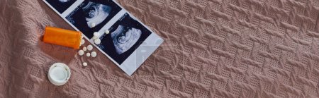 Foto de Vista superior del biberón con pastillas, ultrasonido, feto, control de natalidad, concepto de aborto, pancarta - Imagen libre de derechos
