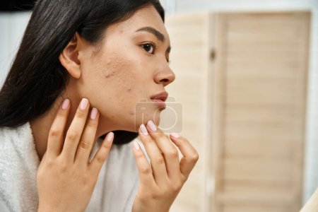 joven asiático mujer con morena cabello examinar su piel con acné en el espejo, problema de la piel