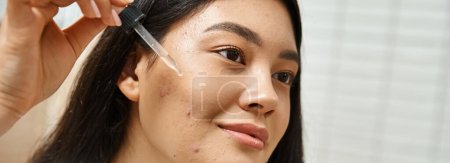 junge und brünette asiatische Frau im Bademantel Anwendung von Gesichtsserum zur Behandlung von Akne im Gesicht, Banner