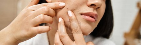 Photo for Banner of cropped asian woman in bath robe popping pimple on her face, skin issues or real people - Royalty Free Image