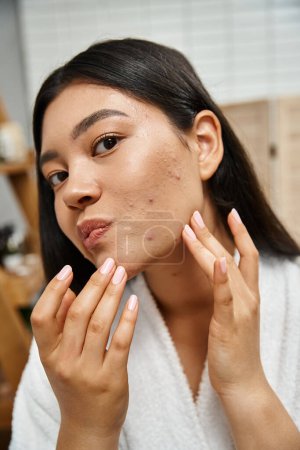 retrato de joven mujer asiática con acné tocando la cara y mirando a la cámara, condición de la piel