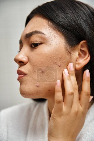 close up of young asian woman with brunette hair and pimples examining her face, skin issues