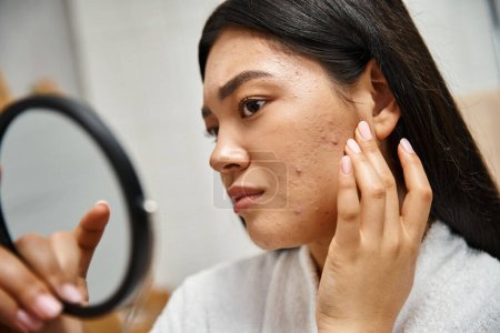 junge asiatische Frau mit brünetten Haaren und Pickeln, die ihr Gesicht im Spiegel betrachtet, Hautprobleme