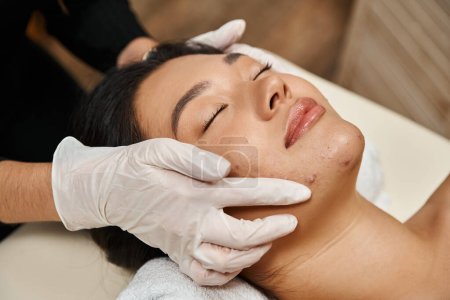 Gesichtsbehandlung für zu Akne neigende Haut, Masseurin in Latexhandschuhen und Asiatin mit geschlossenen Augen