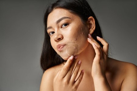 young asian woman with brunette hair and naked shoulders touching acne prone skin on grey background