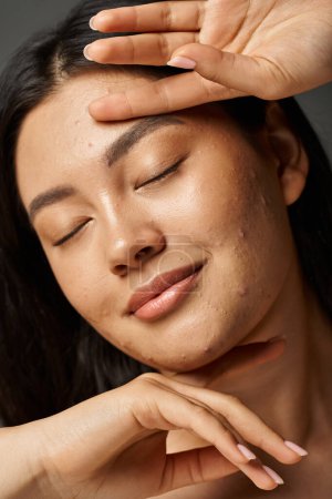 erfreut junge asiatische Frau mit Akne anfälliger Haut und geschlossenen Augen auf grauem Hintergrund, Hautprobleme