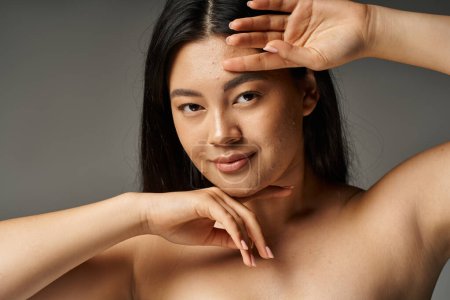 joven asiático mujer con acné propenso piel y desnudo hombros mirando cámara en gris fondo