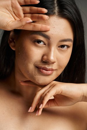 vertikale Aufnahme einer jungen Asiatin mit zu Akne neigender Haut und nackten Schultern, die auf grau in die Kamera schaut