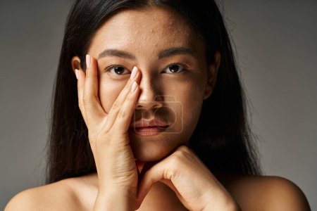 junge asiatische Frau mit Hautproblemen und nackten Schultern schaut in die Kamera auf grauem Hintergrund