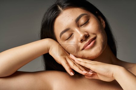 young asian woman with skin issues and bare shoulders smiling with closed eyes on grey background