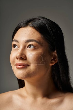 soñadora joven asiática mujer con problemas de piel y hombros desnudos mirando hacia arriba sobre fondo gris