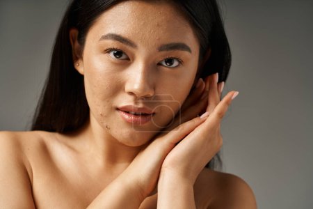 Photo for Brunette young asian girl with skin issues and bare shoulders looking at camera on grey background - Royalty Free Image