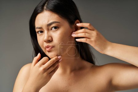 preocupado joven asiática mujer con desnudo hombros tocando su cara con acné en gris fondo