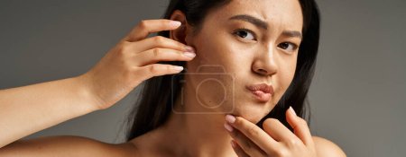 concerned young asian woman with bare shoulders touching her face with acne on grey backdrop, banner