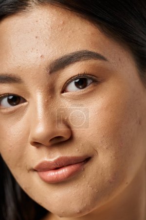 young asian woman with brunette hair and acne prone skin looking at mirror in bathroom, banner