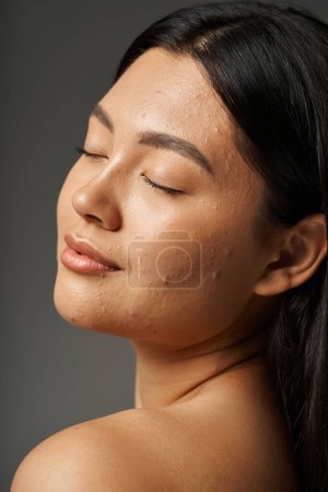 young asian woman with brunette hair and acne prone skin looking at mirror in bathroom, banner magic mug #692761260