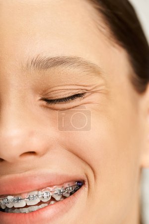 A stylish teenage girl with vibrant attire joyfully smiles, showcasing her braces on her teeth.