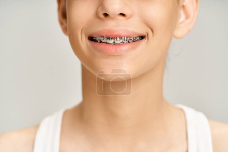 Une adolescente élégante en tenue vibrante souriant vivement, mettant en valeur ses bretelles sur ses dents.