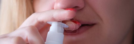 Téléchargez les photos : Femme instillant son nez avec des gouttes vasoconstrictrices gros plan. Concept de traitement de la sinusite aiguë - en image libre de droit