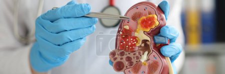 Téléchargez les photos : Urology and treatment of kidney diseases. Doctor performing a kidney examination on a female patient with kidney disease - en image libre de droit