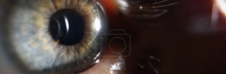 Photo for Laser and young woman closeup of eye. Visiting an ophthalmologist for vision correction - Royalty Free Image