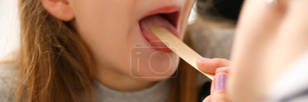 Téléchargez les photos : Otorhinolaryngologist examines child girl with sore throat. Treatment of throat in children and pharyngitis concept - en image libre de droit