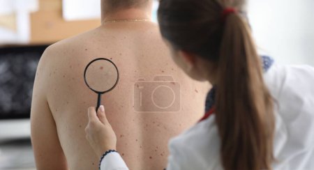 Téléchargez les photos : Oncologue tient la loupe à la main et examine les naevus pigmentés sur les patients de retour à la clinique. Diagnostic des tumeurs cutanées malignes concept. - en image libre de droit