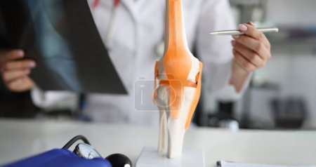 Arzt zeigt Anatomie des Kniegelenks und Röntgenbild. Arthrose des Kniegelenks oder Gonarthrose-Konzept