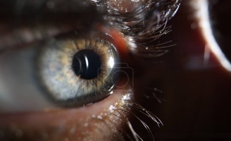 Laser und junge Frau Nahaufnahme des Auges. Besuch beim Augenarzt zur Sehkorrektur