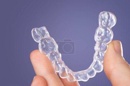Foto de Orthodontic treatment, invisible braces, new orthodontic technology, occlusal splint - Imagen libre de derechos
