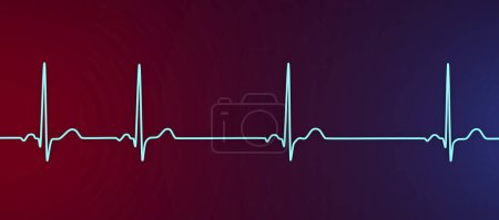 Foto de Ilustración de un electrocardiograma (ECG) que muestra arritmia sinusal, una condición caracterizada por ritmos cardíacos irregulares que se originan en el nodo sinusal. - Imagen libre de derechos