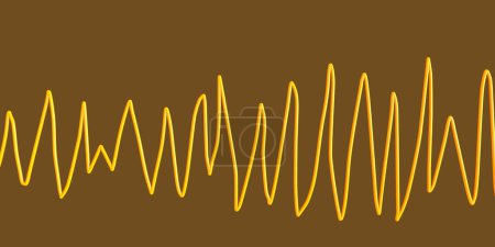 Foto de Ilustración de un electrocardiograma (ECG) que muestra el ritmo de Torsades de pointes. Se trata de un ritmo cardíaco peligroso caracterizado por latidos rápidos e irregulares que giran alrededor del eje eléctrico y que potencialmente pueden causar desmayos o paro cardíaco.. - Imagen libre de derechos