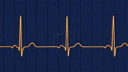Photo for Illustration of an electrocardiogram (ECG) displaying a normal heartbeat rhythm in a healthy individual. - Royalty Free Image