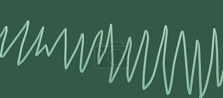 Téléchargez les photos : Illustration d'un électrocardiogramme (ECG) montrant le rythme des torsades de pointes. - en image libre de droit