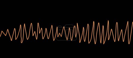 Photo for Illustration of an electrocardiogram (ECG) showing Torsades de pointes rhythm. This is a dangerous heart rhythm characterised by fast, irregular beats twisting around the electrical axis which can potentially cause fainting or cardiac arrest. - Royalty Free Image