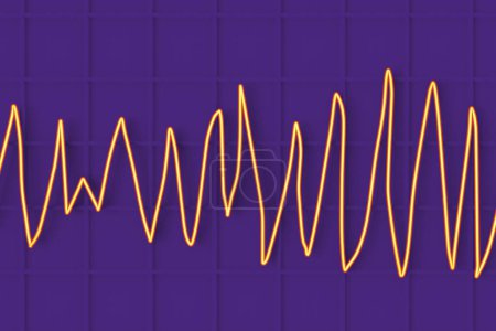 Foto de Ilustración de un electrocardiograma (ECG) que muestra el ritmo de Torsades de pointes. - Imagen libre de derechos