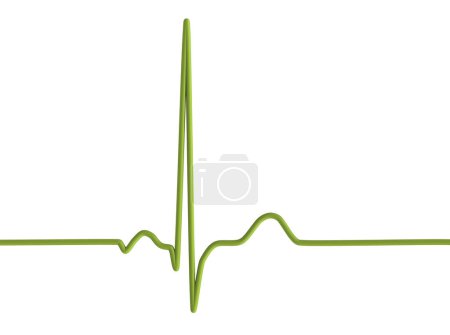 Photo for Illustration of an electrocardiogram (ECG) displaying a normal heartbeat rhythm in a healthy individual. - Royalty Free Image