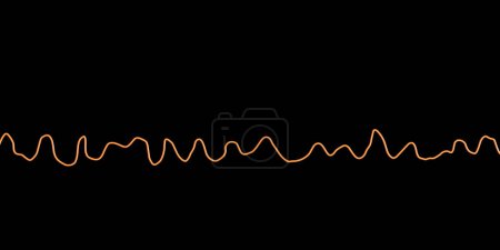 Foto de Ilustración de un electrocardiograma (ECG) que muestra el ritmo caótico de la fibrilación ventricular, una arritmia cardíaca potencialmente mortal. - Imagen libre de derechos