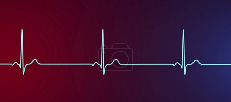 Photo for Illustration of an electrocardiogram (ECG) showing sinus bradycardia. This condition is characterised by a slow heart rate originating from the sinus node, typically below 60 beats per minute. - Royalty Free Image