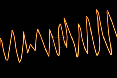 Foto de Ilustración de un electrocardiograma (ECG) que muestra el ritmo de Torsades de pointes. - Imagen libre de derechos