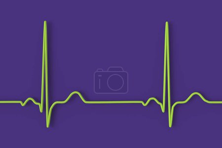 Téléchargez les photos : Illustration d'un électrocardiogramme (ECG) affichant un rythme cardiaque normal chez un individu en bonne santé. - en image libre de droit