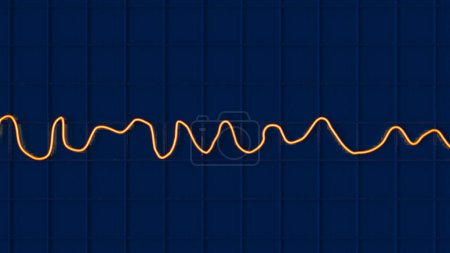 Foto de Ilustración de un electrocardiograma (ECG) que muestra el ritmo caótico de la fibrilación ventricular, una arritmia cardíaca potencialmente mortal. - Imagen libre de derechos